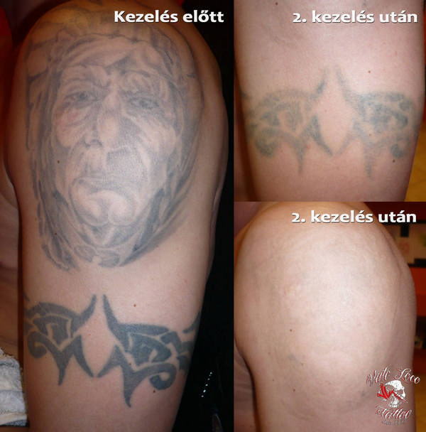 Tetoválások - Tatuantes | Tetoválás (3. oldal)