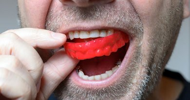 felnőttkori fogszabályozás dentozófiai aktivátorral a fogak védelméért